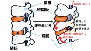 中腰姿勢（前かがみ）が腰に悪いって本当？