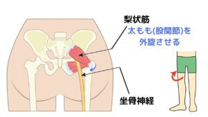 座り過ぎてお尻や脚が痛い・・・梨状筋症候群ってなに？-5