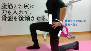 反り腰と坐骨神経痛-10