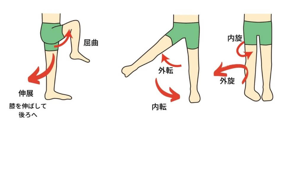 反り腰と坐骨神経痛-4