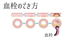 納豆の健康パワー！でも食べ過ぎには注意！-6