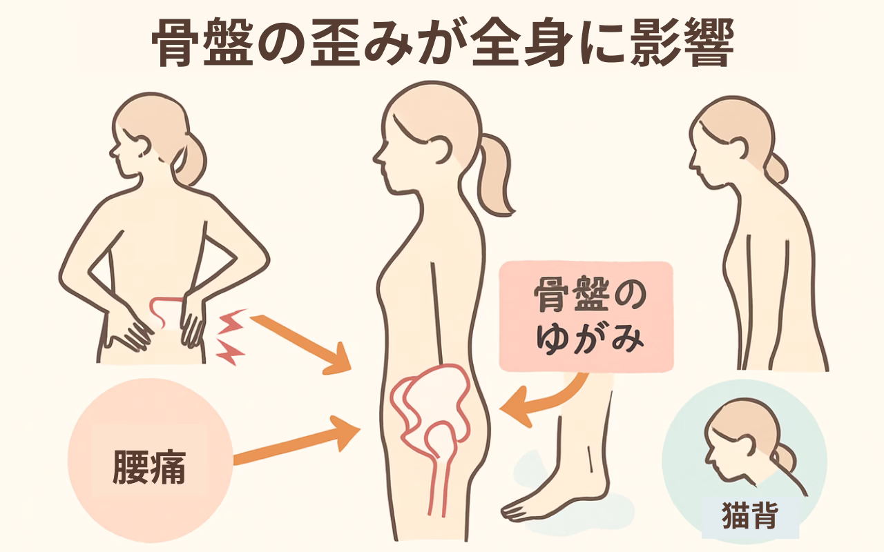 立ち仕事で骨盤が歪む？