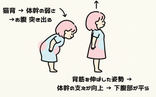 骨盤の正常位置と歪んだ位置を比較した解説イラスト