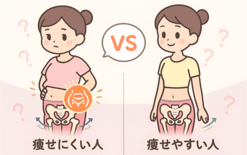 骨盤の前傾と正常位置を並べて比較した、下腹が出る仕組みを示すイラスト