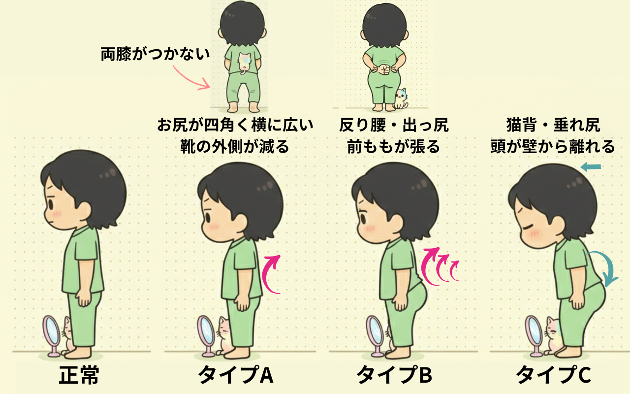 骨盤タイプ別の見た目の特徴と正しい姿勢の比較図